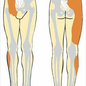 Sciatic Muscle - 3 Questions On Sciatica - Do You Know The "Right" Answers?