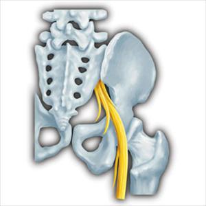 Exercise To Relieve Sciatica - Sciatica- Causes And Treatments: Savannah, GA. Jacksonville, FL.