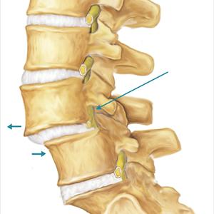 Yoga Pose For Sciatica - The Best & Quickest Exercise To Relieve Sciatica