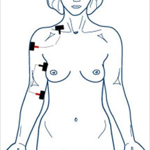 Sciatic Nerve Surgery - Treatment Of Sciatica -- Lying, Sitting, And Standing