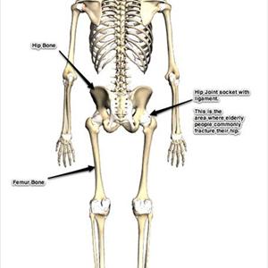 Sciatic Nerve Cushion How To - Top 5 Tips To Treat And Prevent Sciatica