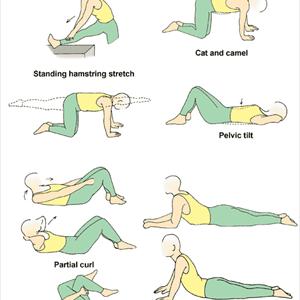 Exercise To Relieve Sciatica - Sciatica- Causes And Treatments: Savannah, GA. Jacksonville, FL.