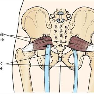 Sciatic Neuralgia Symptoms - How To Weed Out Back Pain And Sciatica Symptoms When Gardening. Hints And Tips For A Bad Back