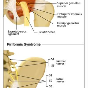 Lower Back Problems Sciatica - The Best & Quickest Exercise To Relieve Sciatica