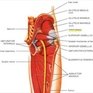 Sciatic Relief - SCIATICA - AYURVEDA