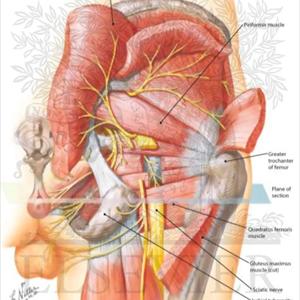 Eat Right For Sciatica - Back Pain Relief Using The DRX9000 - No Inversion Table Hang Ups Here